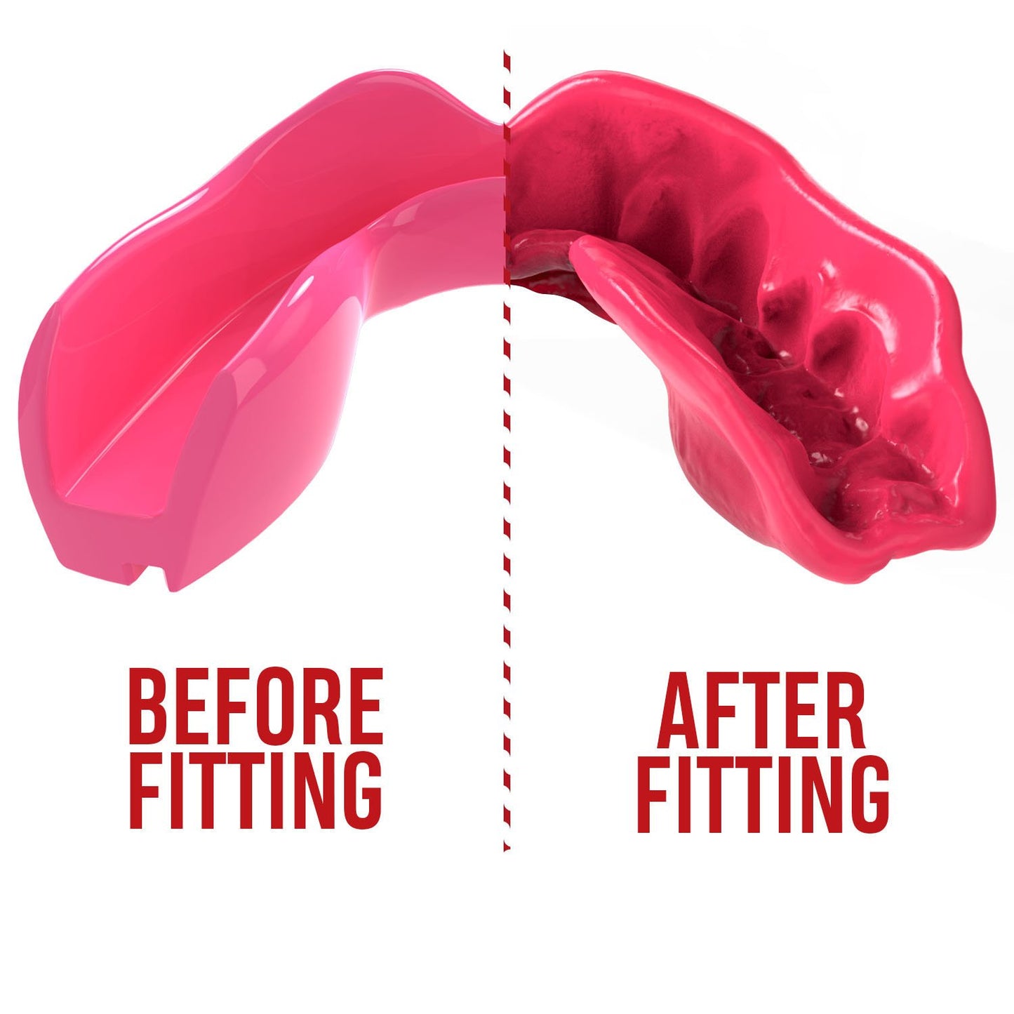 Safejawz Intro Series Zahnschutz - Erwachsene - Pink